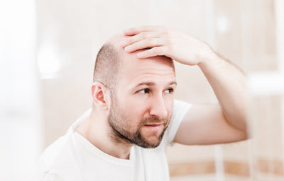 6 Tips to Prevent Hair Loss in Men